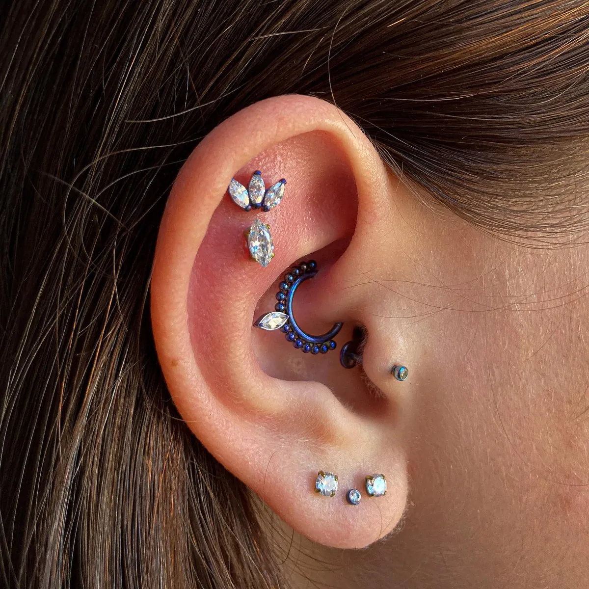Orelha com projeto auricular cicatrizado