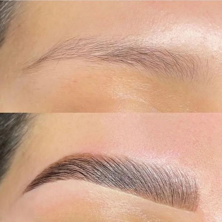 Sobrancelha antes e depois